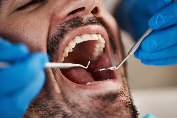 Best Emergency Treatment for Dental Infections or Abscesses in Orwigsburg, PA